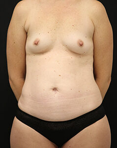 Case # 6 before photo