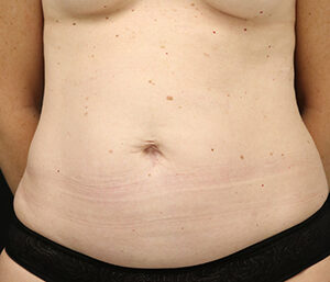 Case # 18 before photo