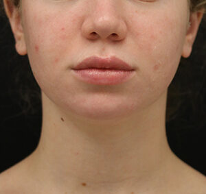 Case # 9 before photo