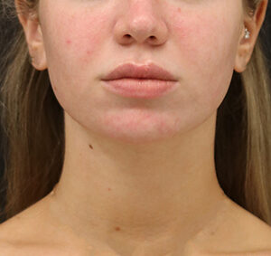 Case # 9 after photo