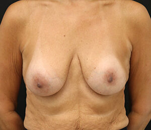 Case # 6 before photo