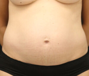 Case # 19 before photo