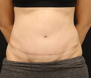 Case # 19 after photo