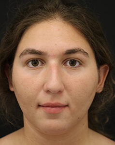 Case # 7 before photo