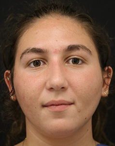 Case # 7 after photo