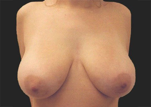 Case # 16 before photo