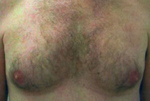 Case # 2 before photo