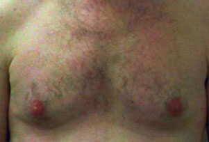 Case # 2 after photo