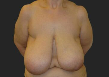 Case # 18 before photo