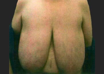 Case # 17 before photo