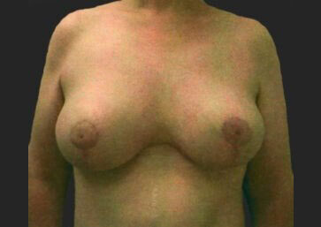 Case # 17 after photo