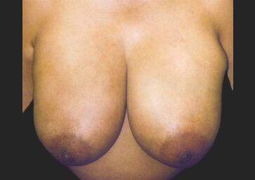 Case # 19 before photo