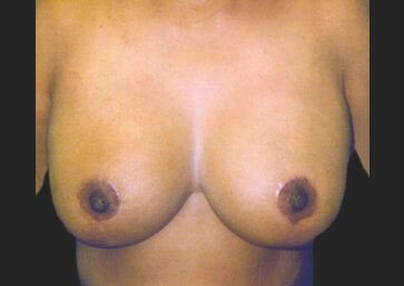 Case # 19 after photo