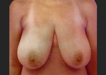 Case # 20 before photo