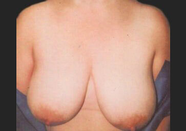 Case # 21 before photo