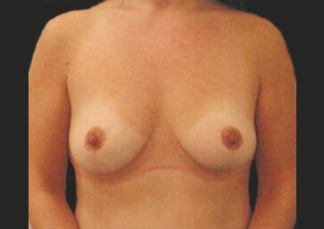 Case # 21 after photo