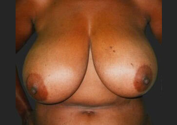 Case # 22 before photo