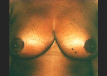 Case # 22 after photo