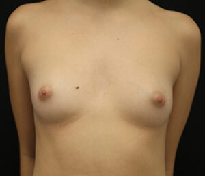 Case # 14 before photo