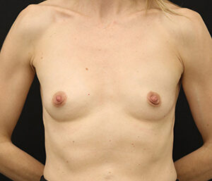 Case # 17 before photo